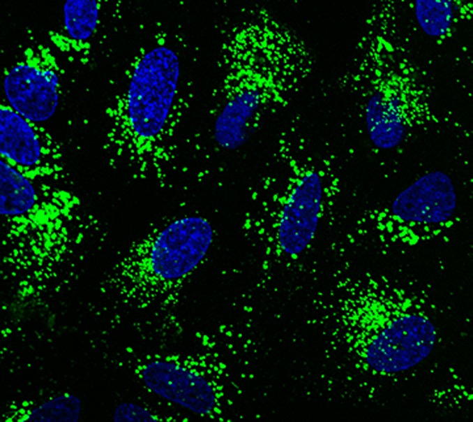 Green-DQ-BSA 溶酶体活性检测 DQ-BSA-GREEN Lysozyme Assay Kit
