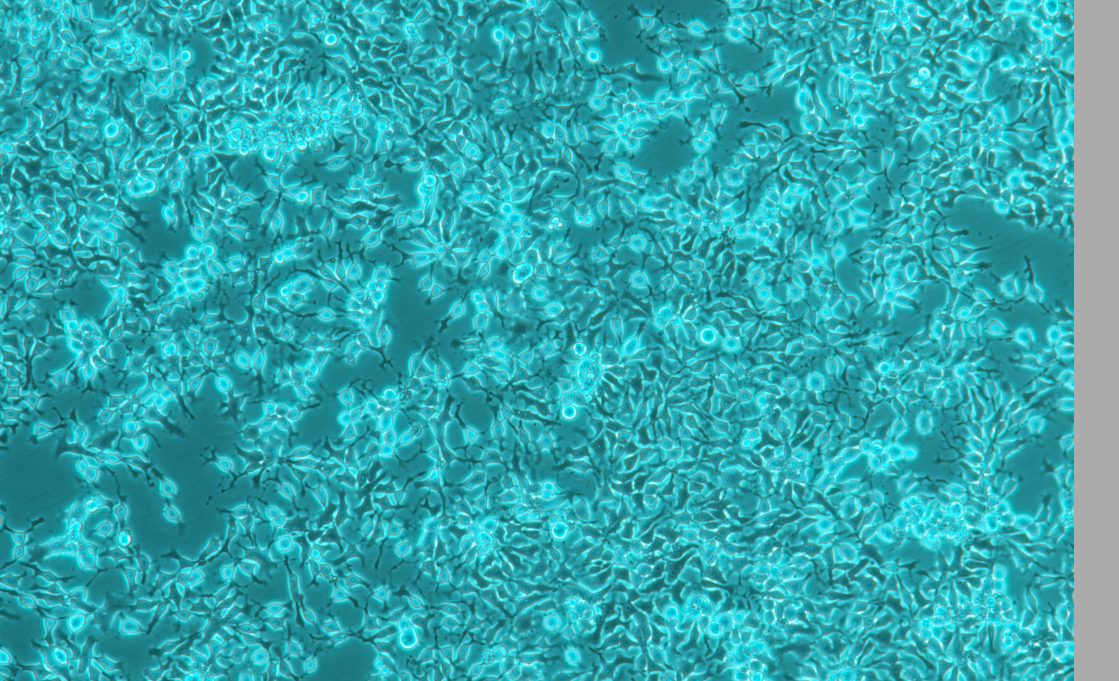 鸡肝癌细胞系LMH（种属鉴定） Chicken liver cancer cell line LMH
