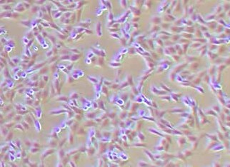 MDBK[NBL-1](Madin-Darby牛肾细胞系)  MDBK (NBL-1) Madin-Darby Bovine Kidney; Madin Darby Bovine Kidney