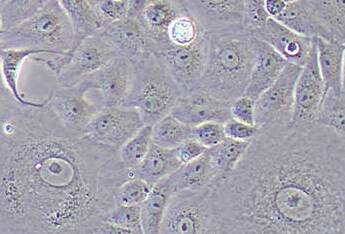 MA-104恒河猴肾细胞系 MA-104 Rhesus monkey kidney cells
