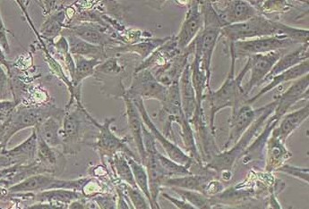羊睾丸间质细胞(永生化细胞） Sheep testicular interstitial cells (immortalized)