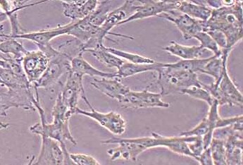 猪主动脉平滑肌细胞(永生化细胞） Immortalization of Porcine Aortic Smooth Muscle Cells - LargeT