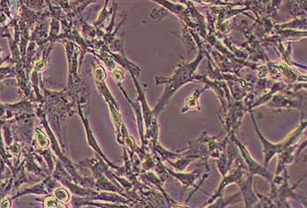 大鼠脑微血管内皮细胞(永生化细胞） Rat brain microvascular endothelial cells (immortalized)
