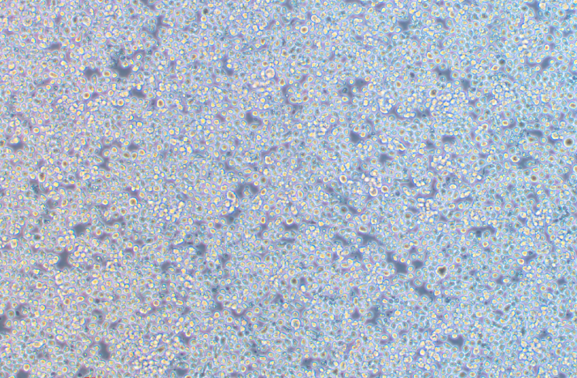 人巨细胞白血病细胞系M-07e(STR鉴定正确) Human giant cell leukemia cell line M-07e
