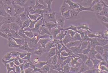 人膀胱癌细胞系RT112(STR鉴定正确) Human bladder cancer cell RT112