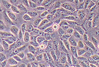 人肺支气管癌细胞系NCI-H1666(STR鉴定正确) Human lung bronchial cancer cell line NCI-H1666