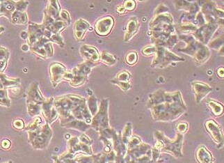 人肺癌腺癌细胞系HCC1833 (STR鉴定正确) Human lung cancer adenocarcinoma cell line HCC1833
