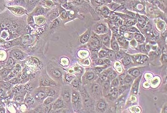 人胰腺癌细胞系 Panc 0813(STR鉴定正确) Human pancreatic cancer cell Panc 0813