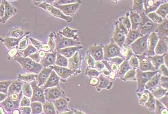 人涎腺腺样囊性癌细胞系SACC-LM(STR鉴定正确) SACC-LM human salivary gland adenoid cystic carcinoma cells