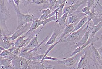 人原代胰腺导管上皮细胞（原代细胞） Human primary pancreatic ductal epithelial cells