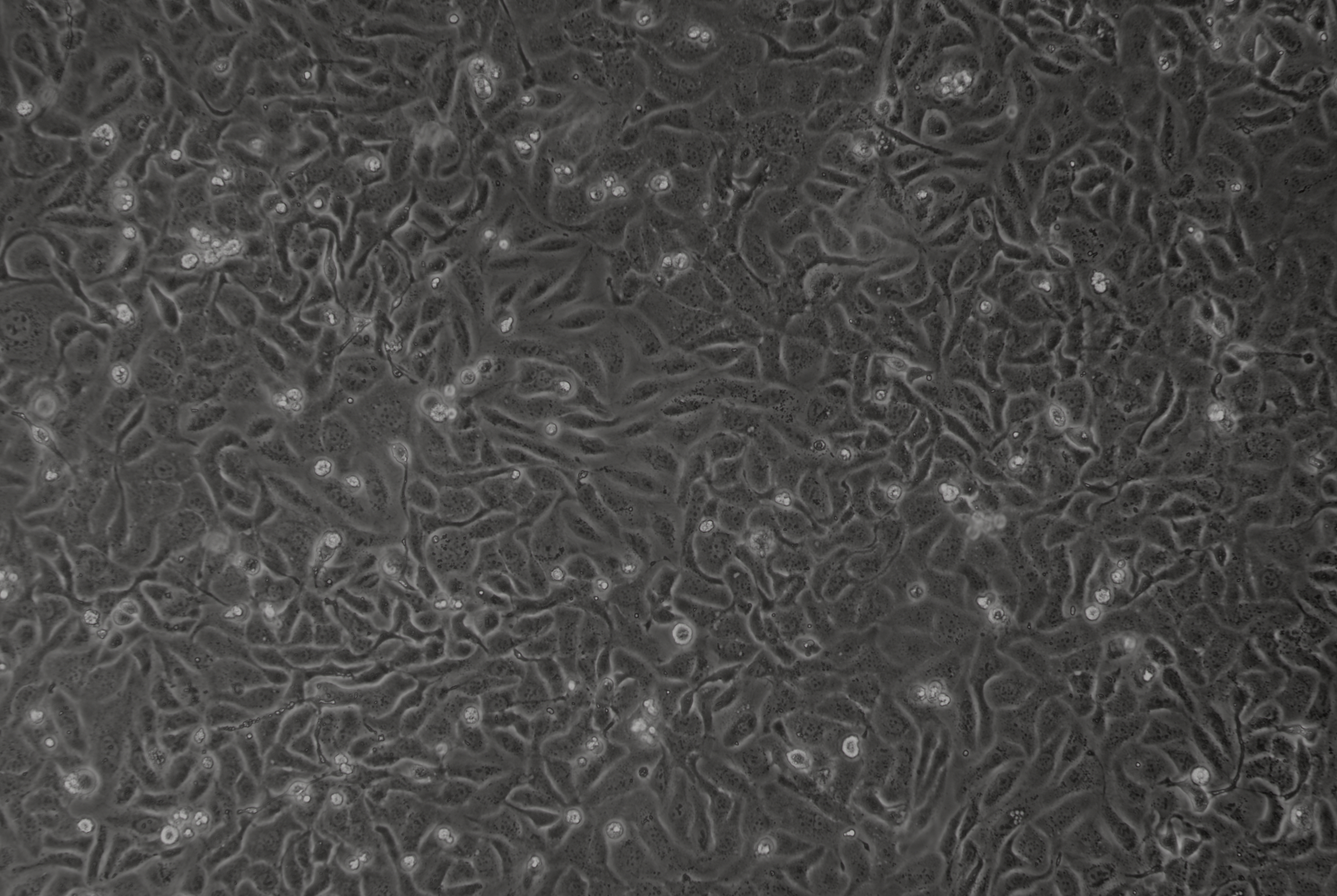 人卵巢癌顺铂耐药株SKOV3/DDP(STR鉴定正确) Human ovarian cancer cisplatin resistant strain SKOV3/DDP