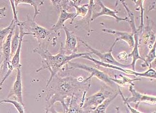 8305C (人甲状腺癌细胞系(未分化)) (STR鉴定正确)