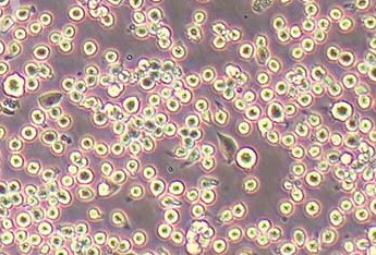 HEL (人红白细胞白血病细胞系) (STR鉴定正确) HEL (human erythroleukemia cells) (STR identification correct)