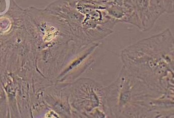 SNU-387 (人肝癌细胞系) (STR鉴定正确) SNU-387 (human liver cancer cells) (STR identification correct)