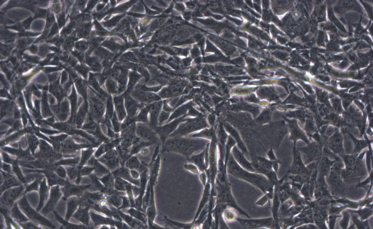 RD人横纹肌肉瘤细胞系 RD human rhabdomyosarcoma cells