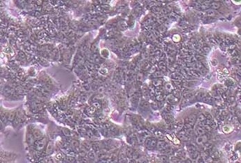T47D人乳腺导管癌细胞系 T47D human breast ductal carcinoma cells
