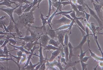 Hey（人卵巢癌细胞系） Hey (human ovarian cancer cells)