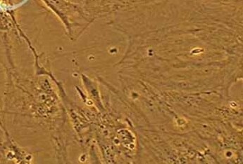 T/G HA-VSMC (人血管平滑肌细胞系) T/G HA-VSMC (human vascular smooth muscle cells)