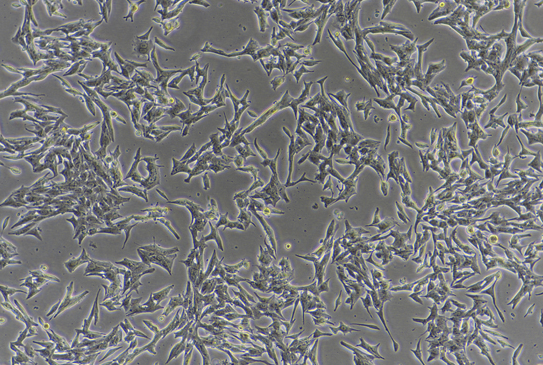 TT人甲状腺癌细胞系 TT human thyroid cancer cells