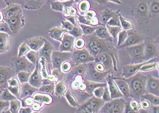 PANC-1-LUC-PURO人胰腺癌细胞（荧光示踪细胞）+luc PANC-1-LUC-PURO human pancreatic cancer+luc