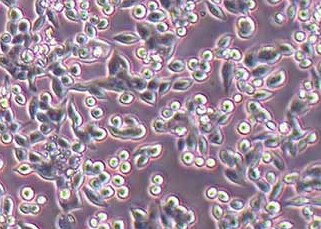 SW620-LUC-puro人结直肠腺癌细胞（荧光示踪细胞）+LUC SW620-LUC puro human colorectal adenocarcinoma cells+LUC
