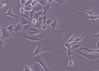 HCT8-LUC-puro人回盲肠癌细胞（荧光示踪细胞）+LUC HCT8-LUC puro human ileocecal cancer cells+LUC