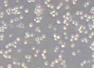 RAMOS-LUC-PURO人B淋巴细胞瘤细胞（荧光示踪细胞）+luc RAMOS-LUC-PURO human B lymphocyte tumor cells+luc
