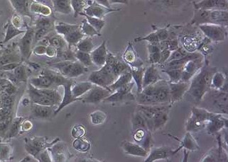 MCF-7-LUC人乳腺癌细胞（荧光示踪细胞）+LUC MCF-7-LUC human breast cancer cells+LUC