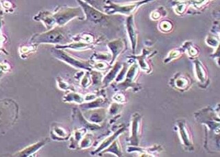 MDA-MB-231-LUC-PURO人三阴性乳腺癌细胞（荧光示踪细胞）+LUC MDA-MB-231-LUC-PURO human triple negative breast cancer+LUC