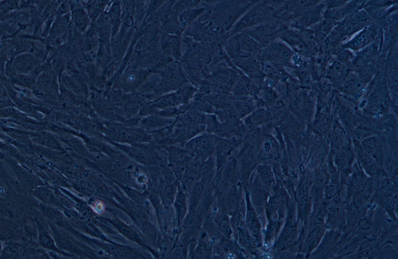小鼠乳腺癌细胞系AT-3（种属鉴定） Mouse breast cancer cell AT-3