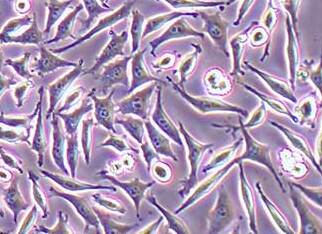 Mccoy小鼠成纤维细胞系 Mccoy mouse fibroblast cells