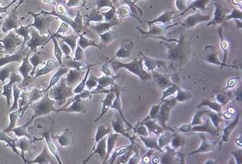 B16-F10小鼠黑色素瘤细胞系 B16-F10 mouse melanoma cells
