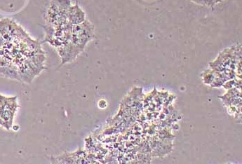 GT1-1小鼠垂体瘤贴壁细胞系 GT1-1 Mouse pituitary tumor adherent cells