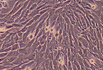 小鼠肝星状细胞(永生化细胞） Immortalization of mouse hepatic stellate cells