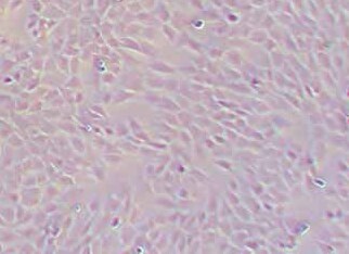 小鼠骨髓巨噬细胞(永生化细胞） Immortalization of mouse bone marrow macrophages