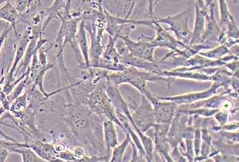 小鼠骨髓间充质干细胞(永生化细胞） Immortalization of Mouse Bone Marrow Mesenchymal Stem Cells - Large T