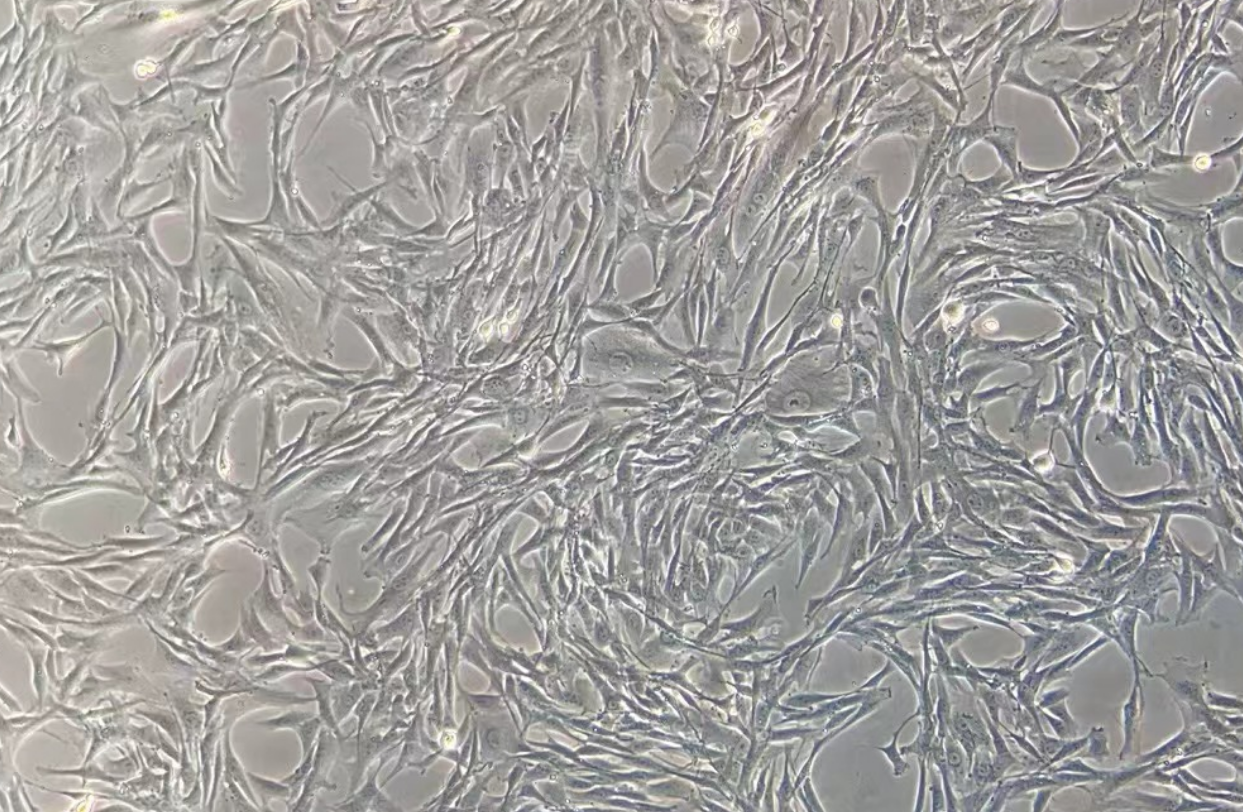 HBZY-1大鼠肾小球系膜细胞系 HBZY-1 rat glomerular mesangial cells
