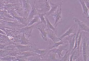 大鼠肌腱干细胞(永生化细胞） Rat tendon stem cells (immortalized)